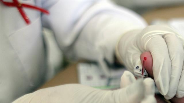 Un vaccin prometteur contre le VIH en cours d’essai