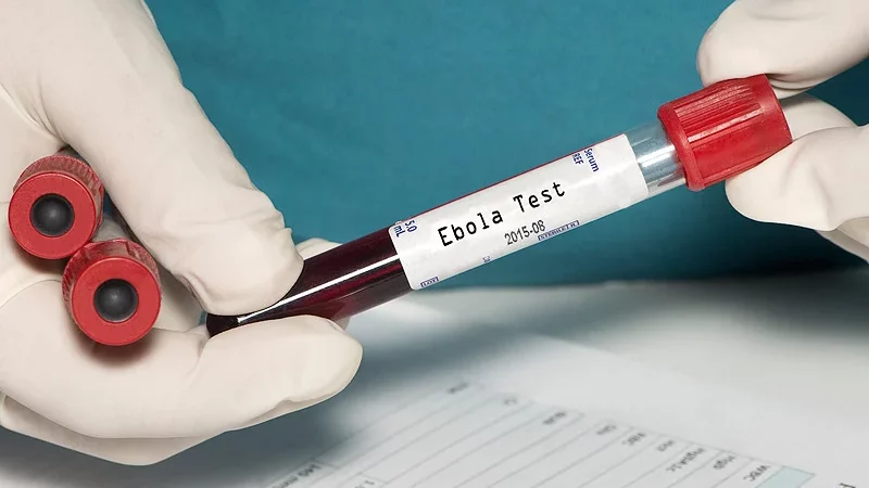Ebola: La Centrafrique évalue ses besoins globaux pour faire face à l’épidémie sur son sol