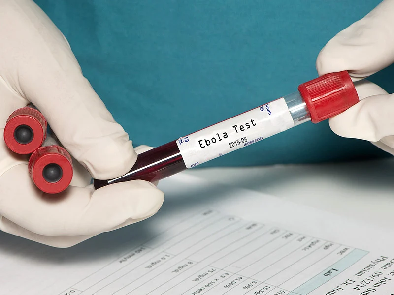 Ebola: La Centrafrique évalue ses besoins globaux pour faire face à l’épidémie sur son sol